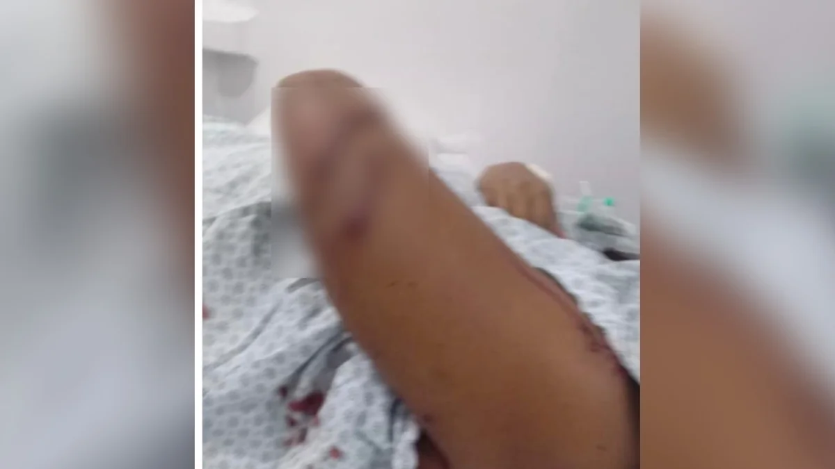 Grávida é atacada com cacos de vidro por namorada do ex-companheiro em GO