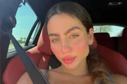 Catherine Bascoy faz harmonização facial