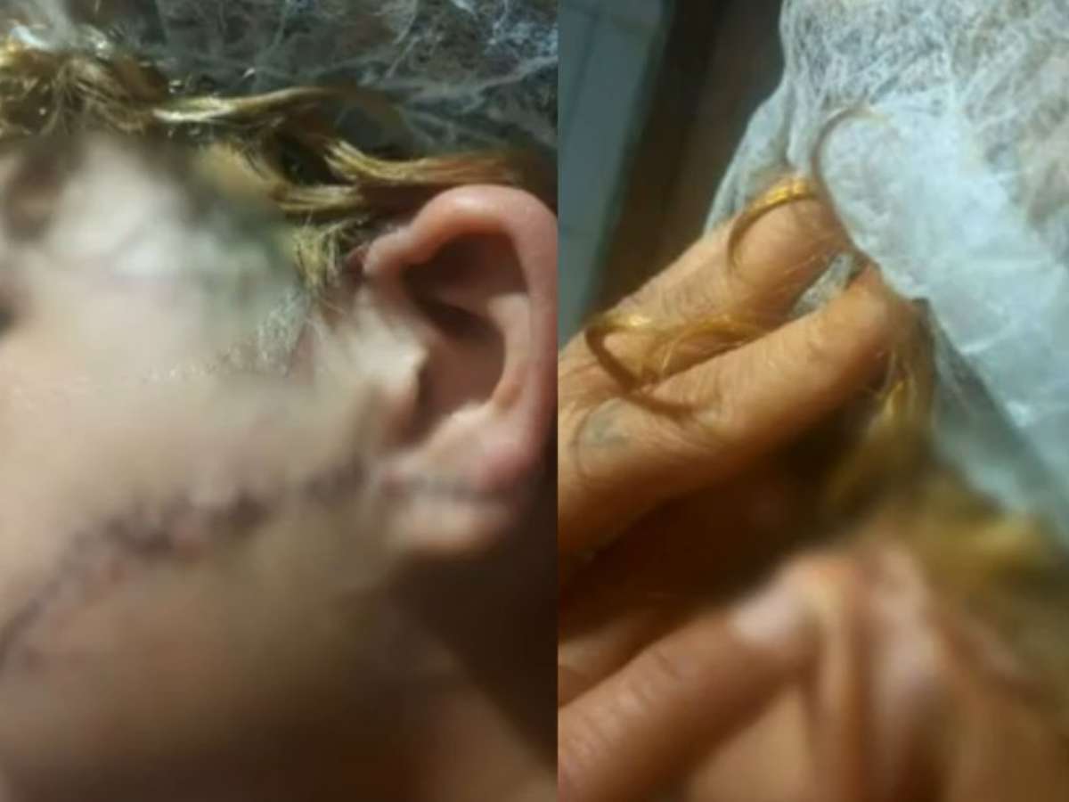 Homem que esfaqueou a ex no rosto e na orelha é preso por tentativa de feminicídio em GO