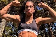 Doença rara faz mulher ter ausência quase total de gordura aparente
