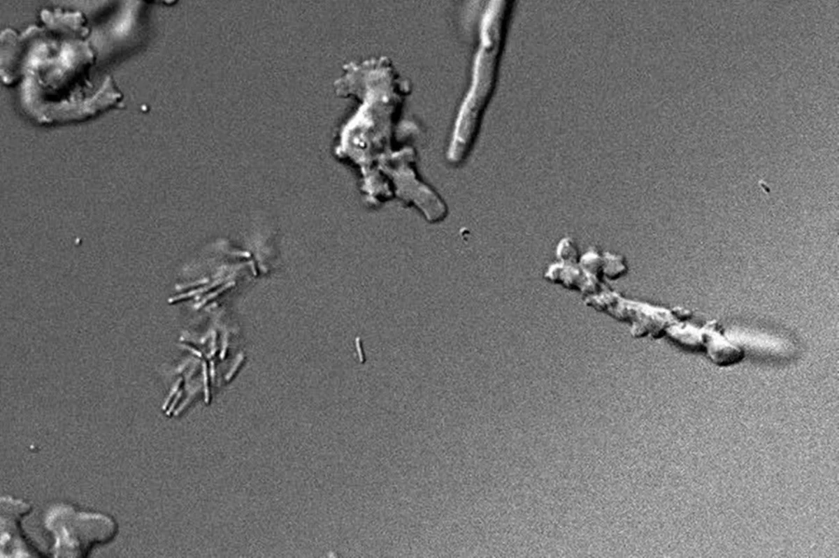 Imagem em preto e branco de ameba de fogo - Metrópoles