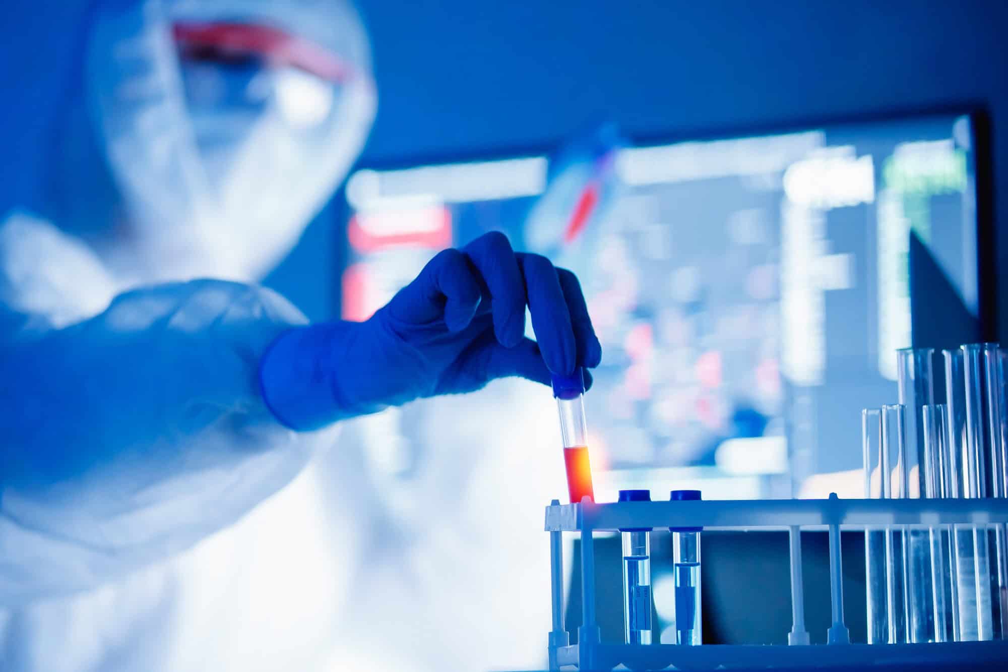 Pesquisador segura tubo de ensaio em laboratório, com equipamentos científicos ao fundo.