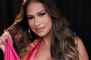 Simone "amarra" fios no nariz em novo procedimento; médico explica técnica