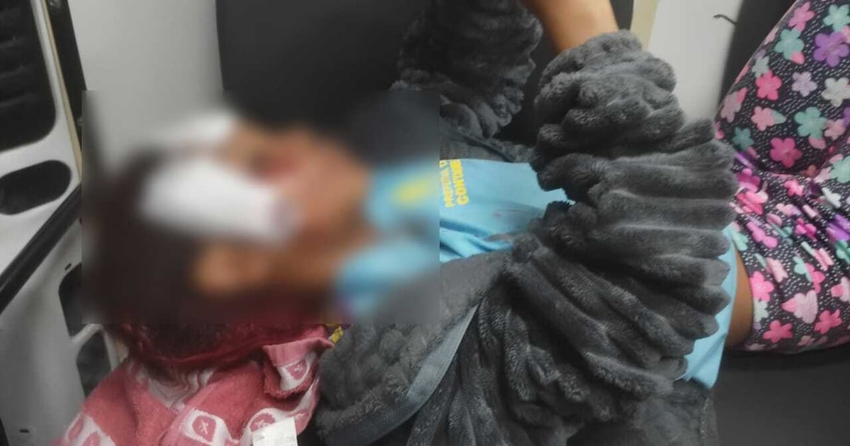 Menina de 7 anos leva pontos no rosto após cair de patinete ao fugir de cachorro em Contagem