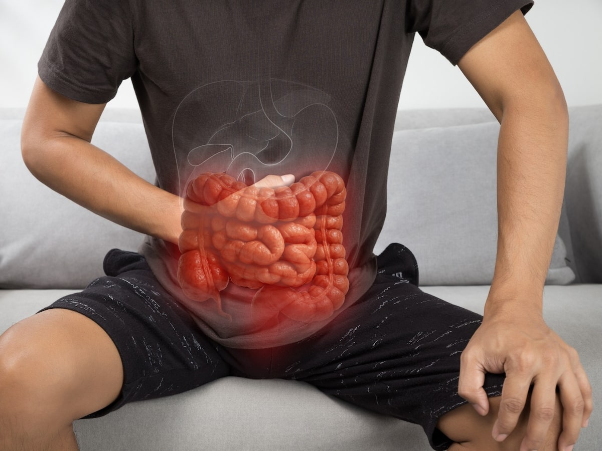 Casos de doenças inflamatórias intestinais aumentam 5 vezes em 13 anos no País; entenda por quê