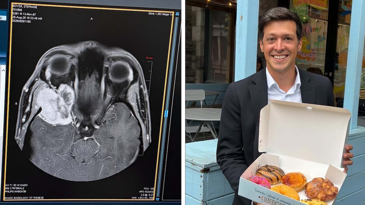 ‘As big as a golf ball’: Laval mayor shares photo of brain tumour