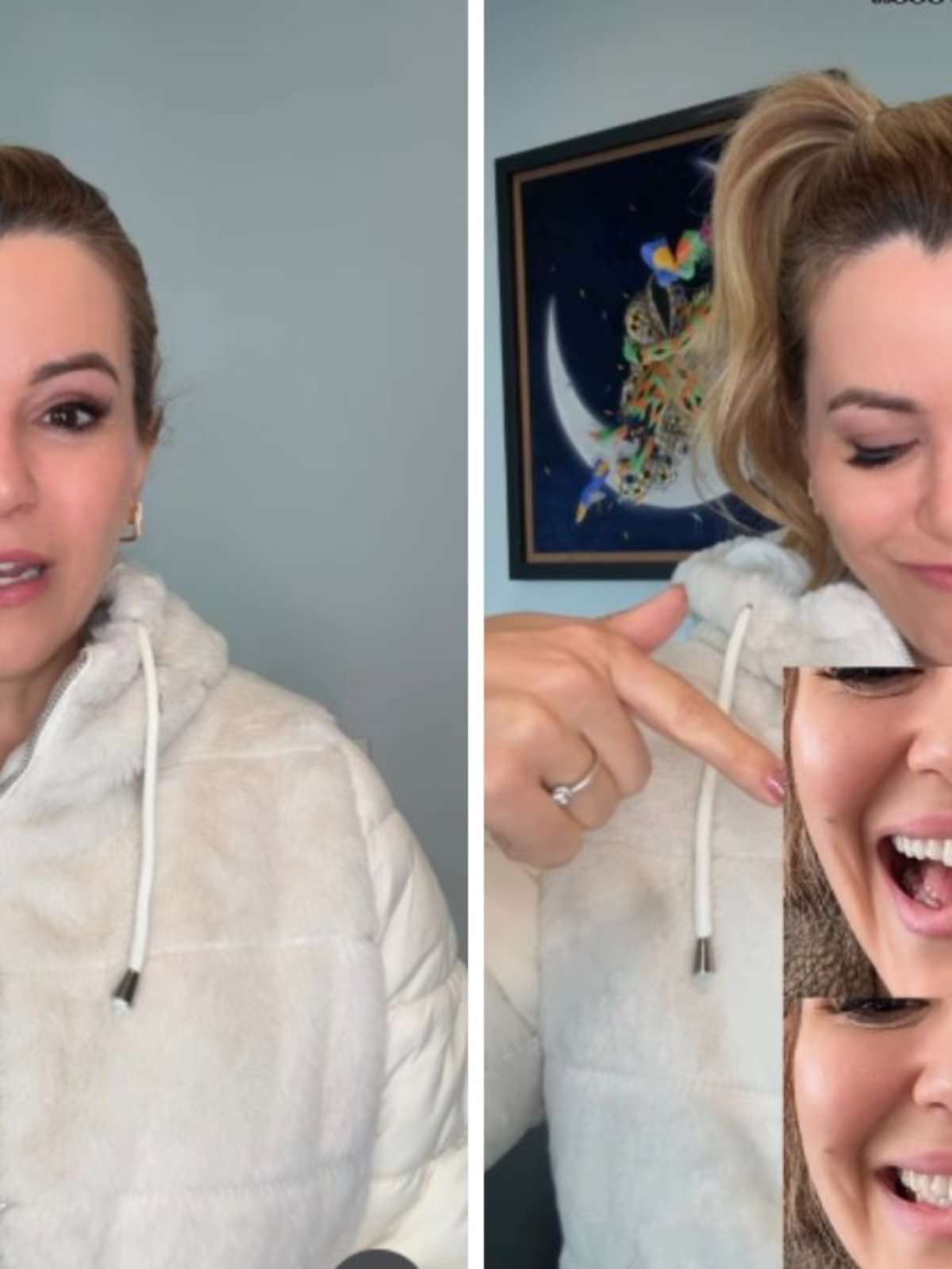 Ex-Panicat Tania Oliveira revela intercorrência em retirada de tumor: 'Meu sorriso ficou comprometido'
