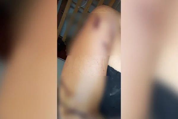 Grávida é atacada com cacos de vidro por namorada do ex-companheiro em GO