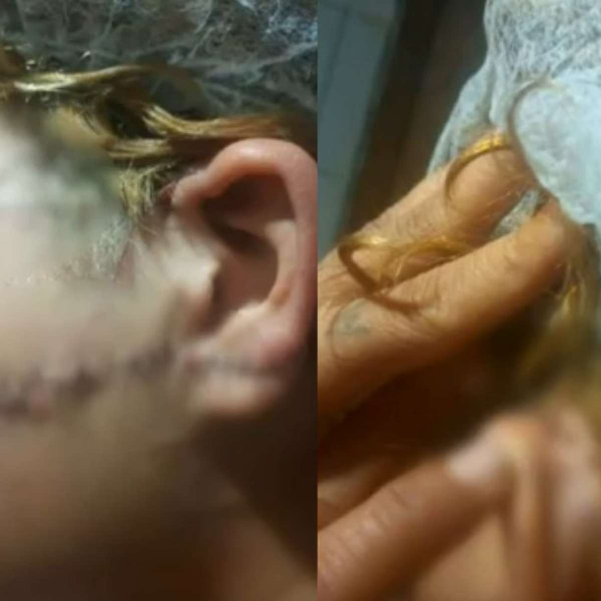 Homem que esfaqueou a ex no rosto e na orelha é preso por tentativa de feminicídio em GO