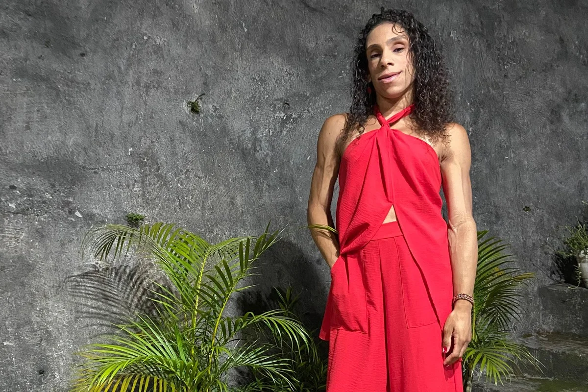 Doença rara faz mulher ter ausência quase total de gordura aparente