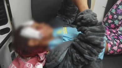 Menina de 7 anos leva pontos no rosto após cair de patinete ao fugir de cachorro em Contagem