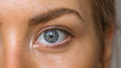 Not all eye conditions start with loss of vision. (Unsplash)