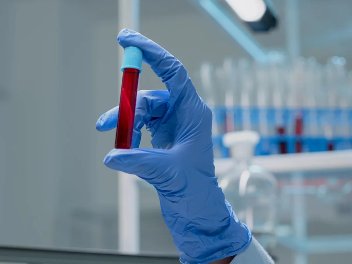 Novo exame de sangue que detecta mais de 50 tipos de câncer chega ao Brasil
