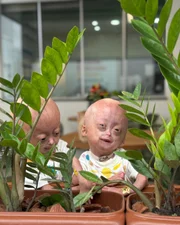 Mãe de Elis, influencer mirim com síndrome rara, lamenta a morte. Veja